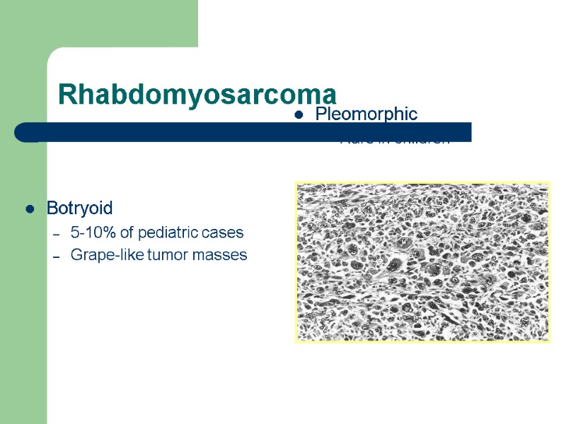 Rhabdomyosarcoma Botryoid 5-10% of pediatric cases Grape-like tumor masses Pleomorphic Rare in children 